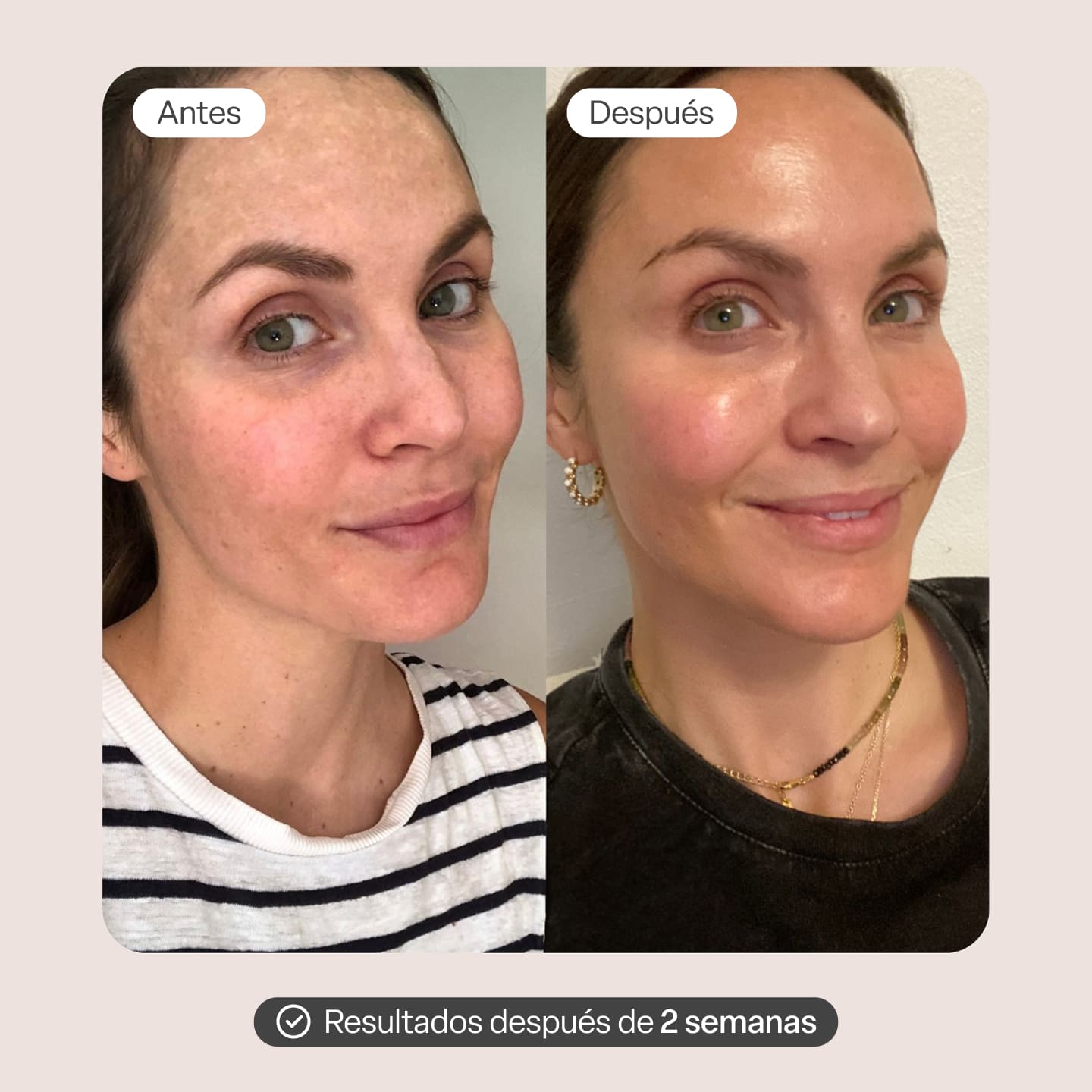 Varita Infinite Glow & 2 Serum Activador